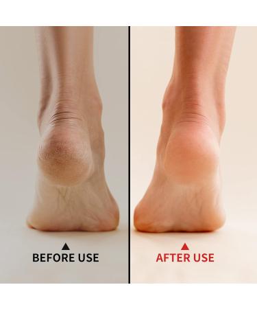 Pedicure Foot File Foot Callus Remover for Hard Skin Foot Care Scrubber Pedicure Tool Anti-Rust Foot Hard Skin Remover Double-Sided Use for Men Women Dry and Wet Feet Cracked Feet Cracked Heels - Buy Online on GoSupps.com