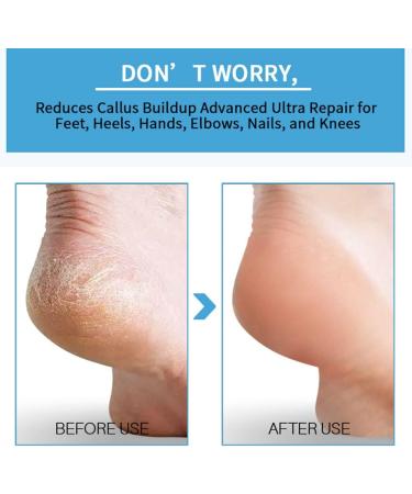 JAWSEU Foot Peeling Spray moisturizing nourishing peeloff spray spray for care dry rough foot skin and mild callus peeling for men and women 50 ml - Buy Online on GoSupps.com