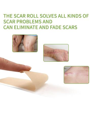 Premium Silicone Scar Tape - Medical-Grade Pain-Free Solution for All Scars - Easy Application & Removal - Buy Online on GoSupps.com