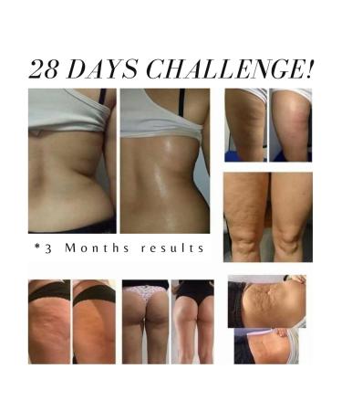 Goldine Care CRYOACTIVE GEL - Soothing and Cooling Relief for Pain and Inflammation - Buy Online on GoSupps.com