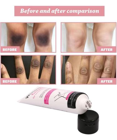  Rakiuty Underarm Whitening Cream Whitening Cream Skin Lightening Cream Armpit Whitening Cream Effective for Underarms and Elbows Whitens Nourishes 50 ml - Buy Online on GoSupps.com