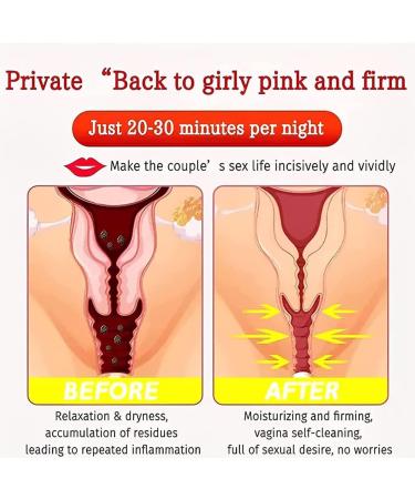 Anniecare Natural Vaginal Detox Capsules & Gel - Anti-Itch, Slimming & Repair - 5 Bags - Buy Online on GoSupps.com