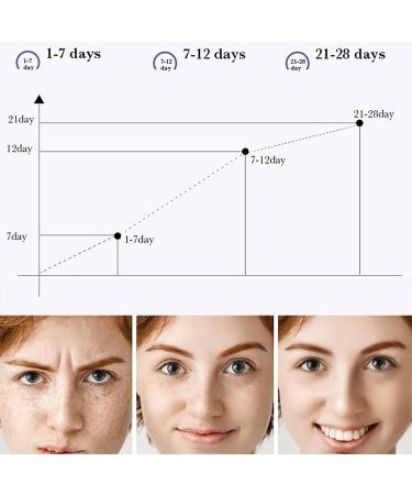 Premium Dark Spot Remover for Face - Niacinamide Cream for Age Spots Sun Spots and Freckles - 20G - Buy Online on GoSupps.com