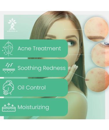 Salicylic Acid Facial Clay Mask for Acne with Vitamin C & Aloe Vera - Deep Pore Cleansing 4.23 OZ | International Shipping Available - Buy Online on GoSupps.com