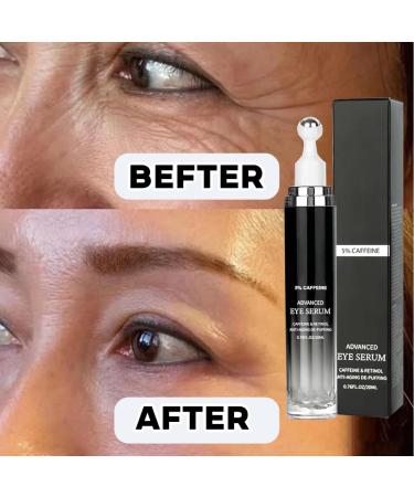 1 Pi ce Cr me Anti-Rides pour les Yeux Contient la Niacinamide et la Vitamine C Pour R duction de l'Hyperpigmentation Contre le M lasma Taches de Vieillesse 20 ml - Buy Online on GoSupps.com