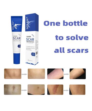 Scar Removal Gel for Stretch Marks & Burns - Natural Skin Care Gift Basket - One Size - Color - Buy Online on GoSupps.com