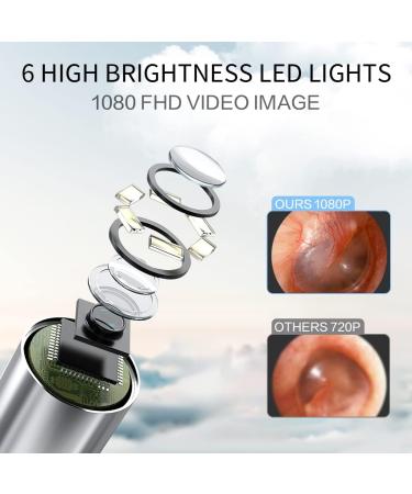 1080P FHD Wireless Ear Wax Camera & Cleaner Set - New Version for Kids, Adults, Pets - 6 LED Light Ear Wax Removal Tool - Black - Buy Online on GoSupps.com