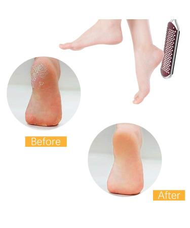 Effective Corn Skin Remover for Feet | Cornhauting Horn Skin Treatment - International Shipping Available - Buy Online on GoSupps.com