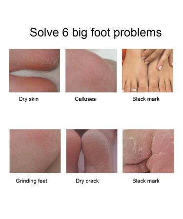 Peeling Foot Mask - 7-Piece Dead Skin Exfoliator for Cracked Heels & Dry Feet | Moisturizing & Whitening Foot Care - Buy Online on GoSupps.com