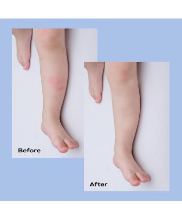 KAMEDIS Eczema Therapy Soothing Body Cream - Clinically Proven Itchy Relief for Dry & Sensitive Skin | Botanicals-Based & Dermatologist Recommended | Paraben-Free 2pk - Buy Online on GoSupps.com