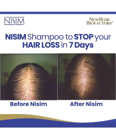 Nisim Hair Loss Treatment ReGrowth Shampoo Conditioner Serum Men Women (1 month supply) - Buy Online on GoSupps.com