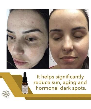 Buy Tonico Aclarante Facial | Best Dark Spot & Blemish Remover | Aqua Labs Colombia - Buy Online on GoSupps.com