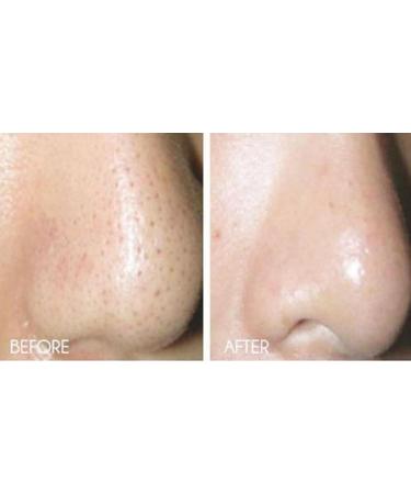 AntiAging Peel Pads-30% Glycolic Cell Renewal Peel Pads+ Salicylic Lactic Acid Argireline DMAE 50 Count (Pack of 1) - Buy Online on GoSupps.com