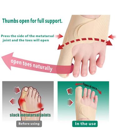 Ashomie Ultra Thin Bunion Corrector & Toe Separator for Women | Orthopedic Bunion Socks (2PC) | Size 4.5-6 - Buy Online on GoSupps.com
