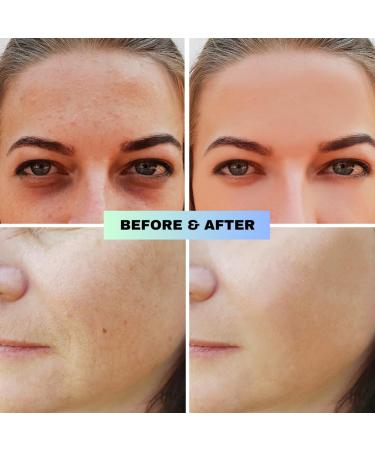 Niacinamide Serum for Brightening & Repairing Damaged Skin | Reduce Blemishes Acne & Pores | Anti-Wrinkle Moisturizer - Buy Online on GoSupps.com