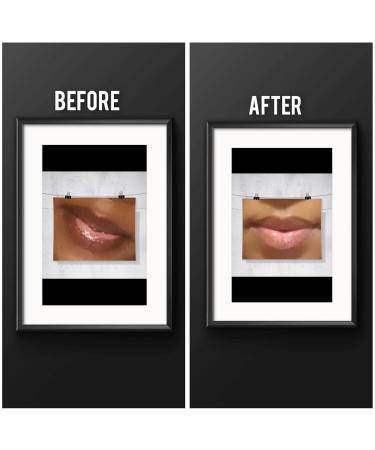 Hydrating Night Lip Treatment Balm | Repair & Nourish Your Lips | Beauty & Personal Care - Buy Online on GoSupps.com