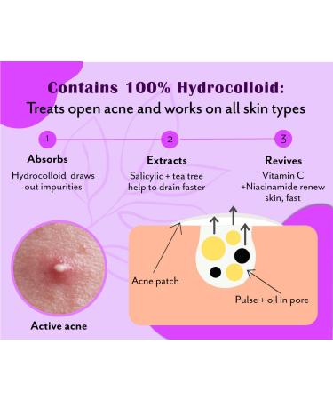 Curvy Pimple Patch for Large Spots - Fast & Effective Acne Treatment | Shop Now - Buy Online on GoSupps.com