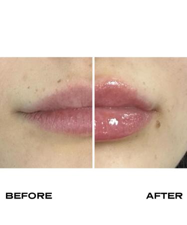 Plump It! Volumising Lip Oil - Clear Lip Plump Oil for Instant Fuller Softer Lips - International Shipping Available - Buy Online on GoSupps.com