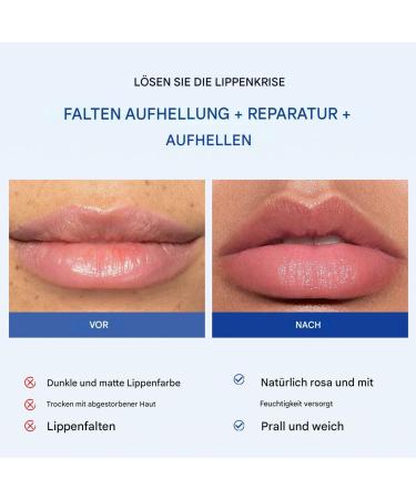  Generisch Moisturizing lip cream hydrating lip balm - 2g - Long-lasting care brightening moisturizing cream for women repairing lotion for a smooth and soft effect - Buy Online on GoSupps.com