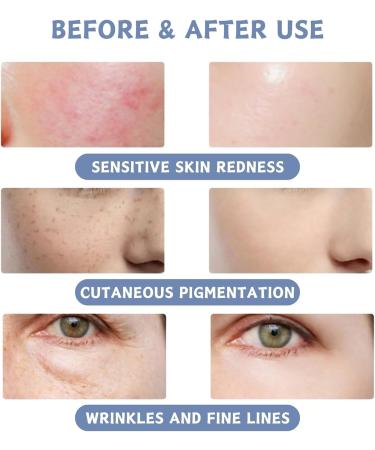 Face Masks Skincare - Hyaluronic Acid Jelly Mask - Face Masks Beauty for Hydrating Smoothing Firming - Skin Care for Jelly Face Mask - Hydrating Face Mask for Face Care - Peel Off Face Masks - Buy Online on GoSupps.com