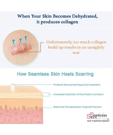 SEAMLESS SKIN Silicone Gel Sheets Set - Scar Removal Treatment for Mastopexy/Areopexy Recovery & Stretch Marks - Post Op Surgery Breast Anchor Lift - Pack of 2 - Buy Online on GoSupps.com