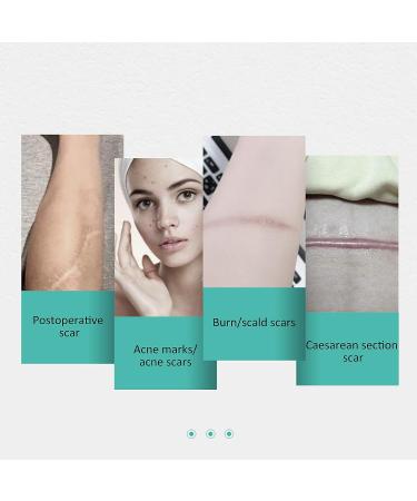 Portable Waterproof Silicone Scar Sheets - 4pcs | Scar Removal Treatment | Breathable & Reusable | Stomach Pads for Men & Women - Buy Online on GoSupps.com