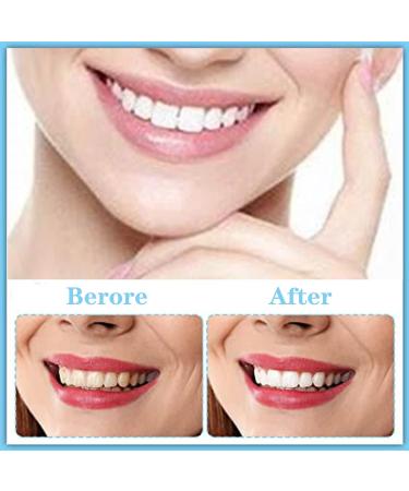 Buy Nitaiun 2-Piece Instant Veneers | Upper & Lower Snap-On Dentures for Perfect Smile - Comfortable Fake Teeth - Buy Online on GoSupps.com