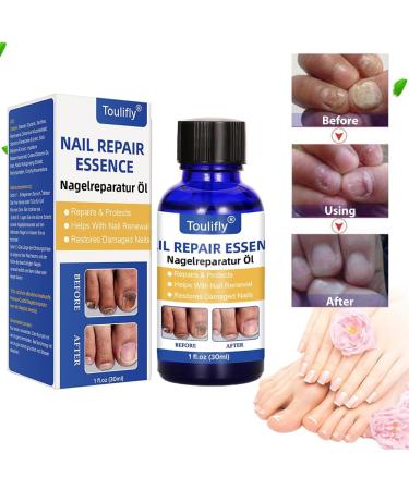 Nail Repair Natural Nail Care Maximum Strength Nail Solution Restores Discolored & Damaged Nails Nail Care Solution - Buy Online on GoSupps.com