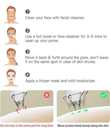 DULASP Blackhead Remover Vacuum USB Rechargeable Electric Face Comedo Extractor Kit Blackhead Remover with 4 Adjustable Suction Head for Facial Skin - Buy Online on GoSupps.com