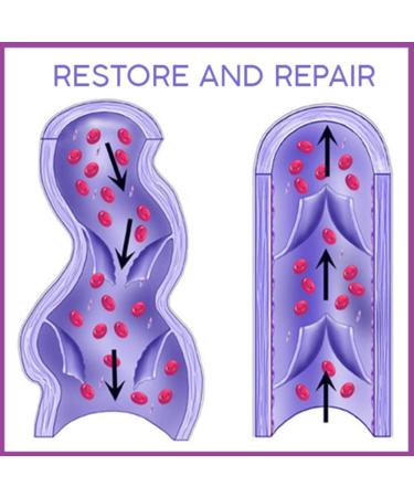 18Pcs Pat Varicose Veins Treatment Plasters - Herbal Medicine for Spider Veins & Vasculitis - Effective Chinese Remedies - Buy Online on GoSupps.com