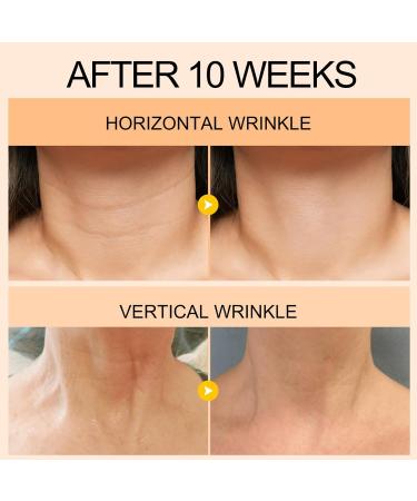 Neck Cream 60g - Skin Tightening & Anti-Wrinkle Formula | La Personal Firming Cream for Sagging Skin & Fine Lines - Buy Online on GoSupps.com