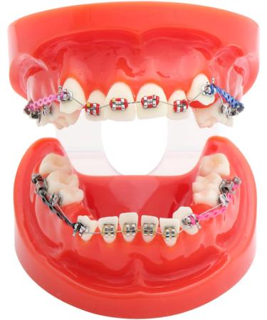 Orthodontic O-Rings & Ties - 40 Transparent Ligature Bonds for Braces | International Shipping - Buy Online on GoSupps.com