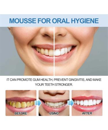 Awzlove Teeth Total Care Mouthwash Awzlove Teeth Mouthwash Mouthwash Toothpaste Foam Mousse Whitening Refreshing Breath and Deep Cleaning Teeth (2Pcs) - Buy Online on GoSupps.com