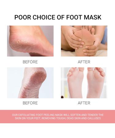 3 Pair Foot Peeling Mask Socks - Moisturizing Foot Mask for Dry & Cracked Feet - Easy Corn Removal - Foot Spa Treatment for Men & Women - Buy Online on GoSupps.com