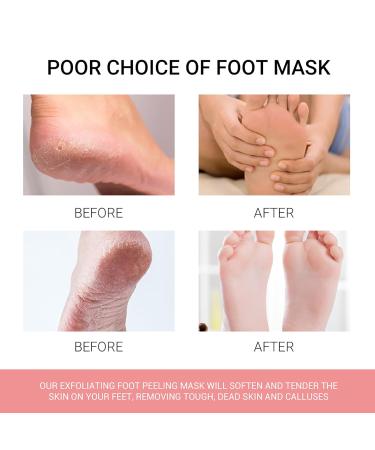 3 Pairs of Foot Masks - Peeling Socks for Soft Smooth Feet | Corneal & Dead Skin Remover | Heal Rough Heels for Men & Women - Peach Peach - Buy Online on GoSupps.com