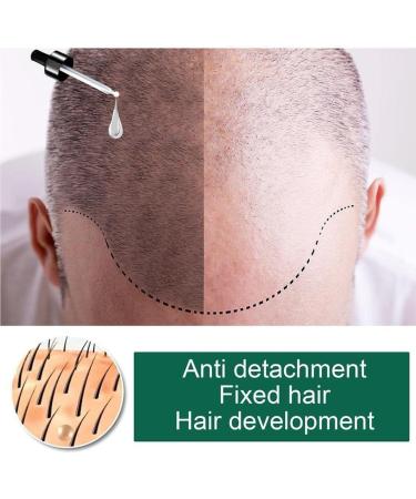 dijiusidy Ginger Hair Growth Oil Prevent Baldness Good-absorption Fast Growing 30MLSerum Nourish Tools Female - Buy Online on GoSupps.com