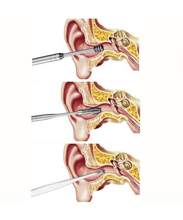 JZK 5-Part Stainless Steel Ear Cleaner Set - Ear Wax C rette Tool & Wet Remover - Premium Gear Cleaning Kit (Silver) - Buy Online on GoSupps.com