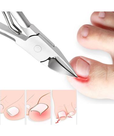 Nail Clipper Toenail Clippers Dead Skin Remove Nail Ingrown Nipper Cuticle Scissors Nail Cutter Paronychia Tools Pedicure Manicure - Buy Online on GoSupps.com