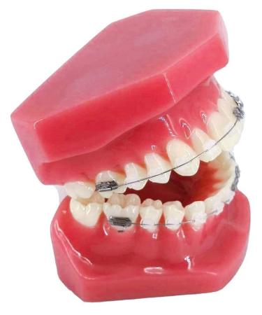 BAUR organ model dental teeth orthodontic model with metal and ceramics clinging oral demonstration models for the dentist to communicate with patients