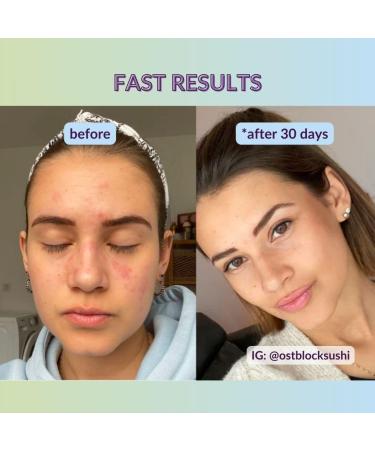 Hyaluronic Acid Moisturiser Gel with Organic Aloe Vera | Natural Vegan Face Care | Intensive Hydration & Anti-Ageing - 100ml - Buy Online on GoSupps.com