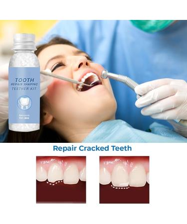 Premium Temporary Denture Set - DIY Heat Fit Beads for Quick Dental Restoration | Prosthesis & Repair Solutions - Buy Online on GoSupps.com