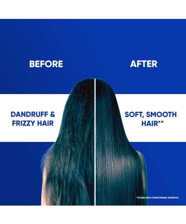 Buy Head & Shoulders Cool Menthol 2-in-1 Shampoo + Conditioner 180ml | International Shipping Available - Buy Online on GoSupps.com