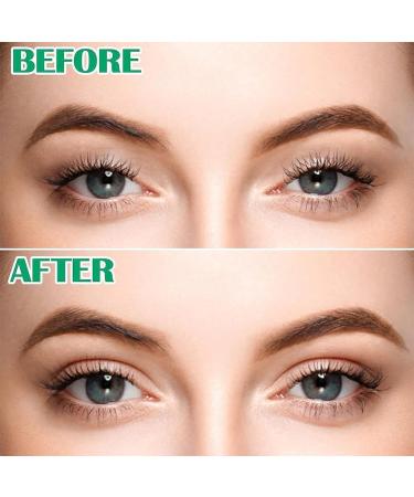 600 Pieces Double Eyelid Tape Eyelid Tape Eyelid Sticker Eyelid Lifter Strips Invisible Double Eyelid Stripes Eyelid Tape Set Double Sided Eyelid Tape Double Eyelid Patch Eyelid Stripes - Buy Online on GoSupps.com