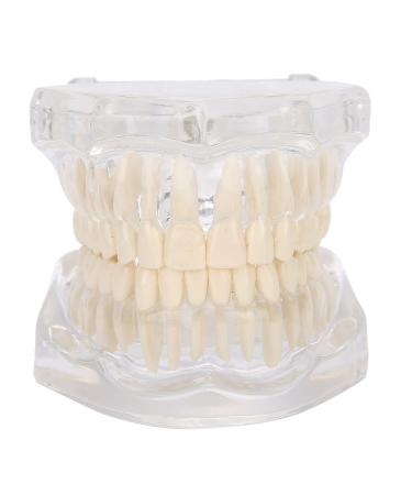 Tooth model transparent acrylic tooth model simulation pathological repair study of dental teaching tools for demonstration