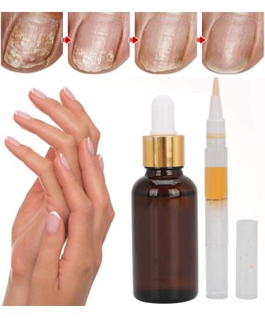 Nail Essential Oil Serum for Long and Healthy Nails - Refreshing Liquid Treatment for Salon and Daily Use - Buy Online on GoSupps.com