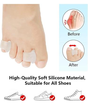 WXHZHQ Toe Spreader - 4 Pairs Transparent Gel Corrector for Bunions & Overlapping Toes - Pain Relief Solution - Buy Online on GoSupps.com