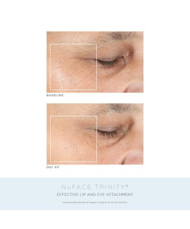 NuFACE Trinity Complete facial toning kit - Achieve firmer, lifted skin - Buy Online on GoSupps.com