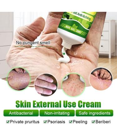 Psoriasis and Eczema Relief Cream - Soothes Dry, Itchy, and Inflamed Skin - Pack of 1 - Buy Online on GoSupps.com