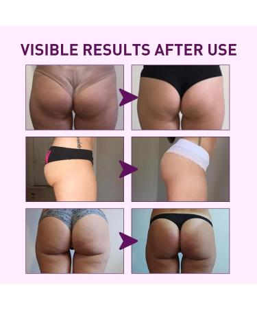 Buy BootyProfi Hip Lifting Massage Oil - Natural Butt Enhancement & Plumping Oil for Firmer Hips (1PC) - International Shipping Available - Buy Online on GoSupps.com