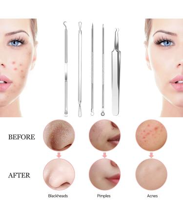 Blackhead Remover Kit - 8 Pcs Stainless Steel Pimple Popper Tool Set for Blemish & Whitehead Removal - Includes Portable Case - Silver - Buy Online on GoSupps.com